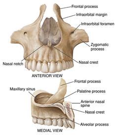 Maxilar-Cráneo: Conducto infraorbitario, Foramen infraorbitario, Espina nasal anterior ...