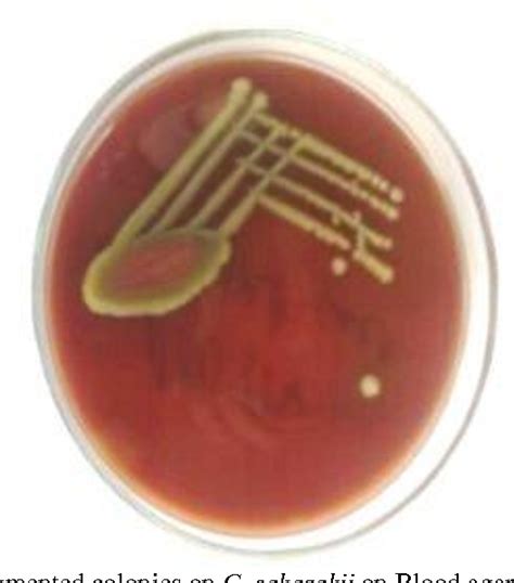 Figure 1 from Cronobacter sakazakii in Adults-A Rare Case Report | Semantic Scholar