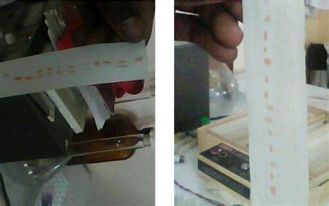 Figure 1 from Effects of sex and haemoglobin types on gene and allelic frequencies in Red Sokoto ...