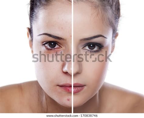 Womans Face Before After Makeup Digital Stock Photo 170838746 | Shutterstock