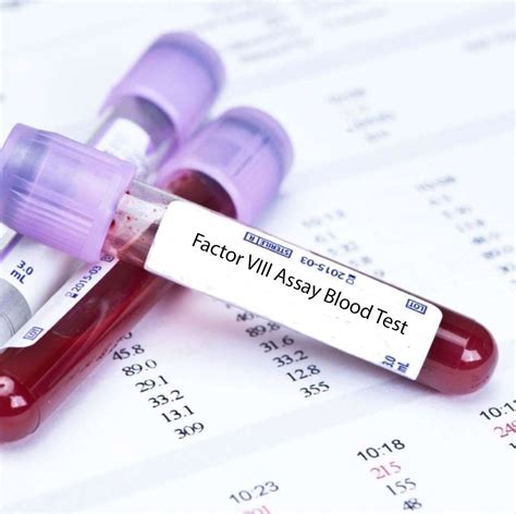 Factor VIII Assay Blood Test | Blood Tests in London