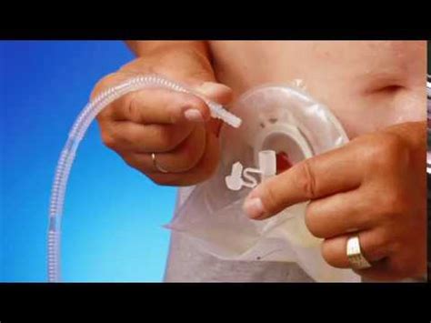 How to connect a urostomy pouch to night drainage bag - YouTube