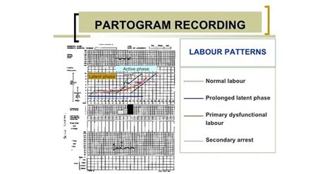 Partogram - www.medicoapps.org