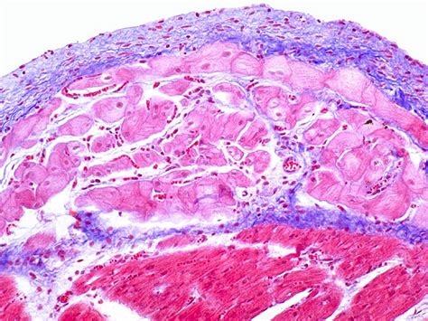 Purkinje Cells Histology