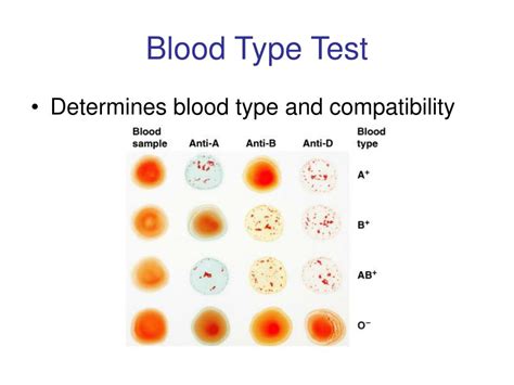 PPT - Blood Typing Lab PowerPoint Presentation, free download - ID:776386