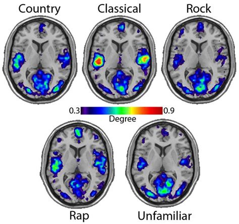 3 ways music therapy improves brain function – Artofit