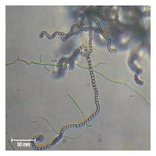 Microscopic morphology of selected Streptomyces examined by using a ...