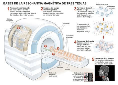 Infográfico. Cómo funciona la resonancia magnética 3 teslas. Clínica ...