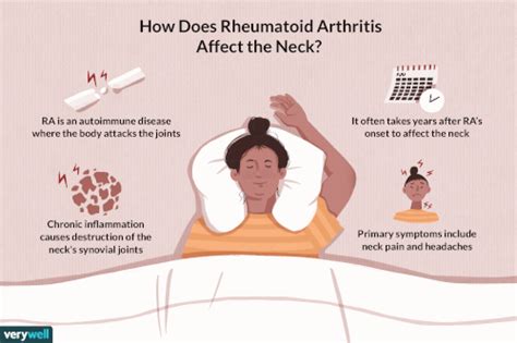 Rheumatoid Arthritis in the Neck: Overview and More