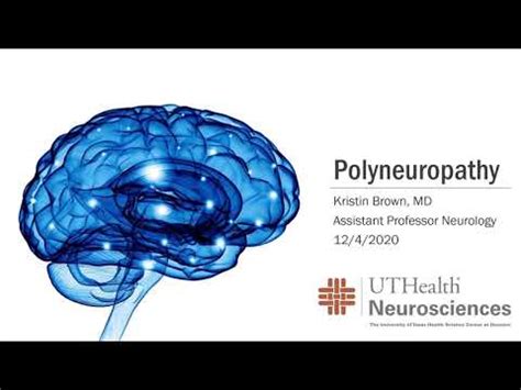 Polyneuropathy Symptoms, Diagnosis and Advanced Treatment Options - YouTube