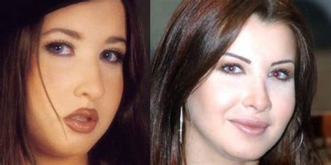 Nancy Ajram Before and After: Has the Lebanese Singer Undergone Plastic Surgery? - OtakuKart