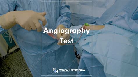 What Is an Angiography Test? Filipino Guide to Angiogram - Medical Trends Now