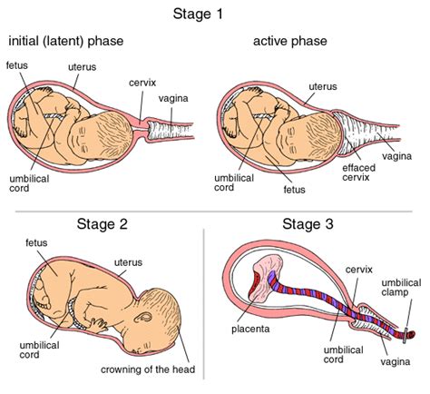 Stages Of Labor Diagram