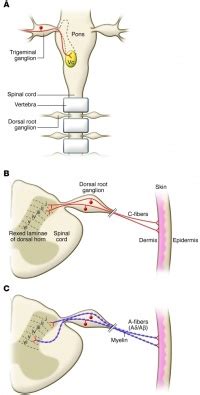 Multidimensional Nature of Pain - Physiopedia