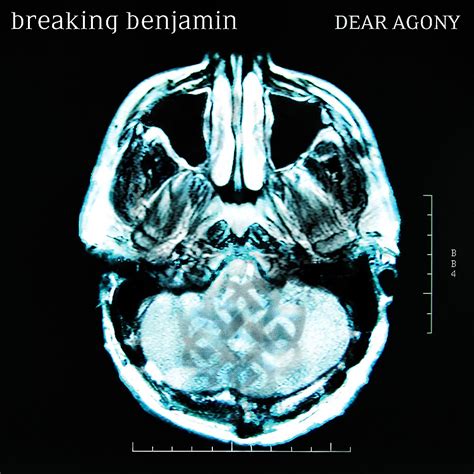 Breaking Benjamin - Dear Agony | Metal Kingdom