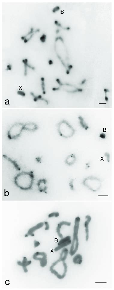 C-banding revealing the heterochromatin location in diplotene... | Download Scientific Diagram