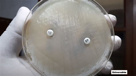 Novobiocin Susceptibility Test: Introduction, Principle, Procedure, Result Int