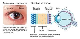 Laser Refractive Surgery - LASIK