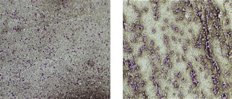 11 questions with answers in BACTERIAL CAPSULES | Science topic