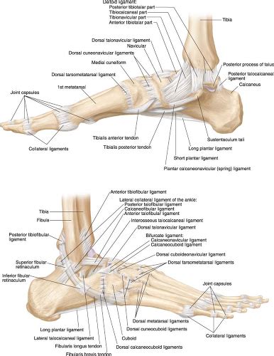 Calcaneal Spur Xray