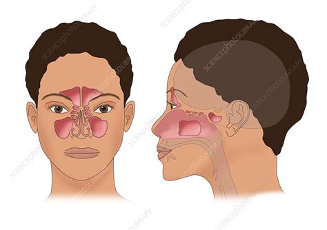 Sinus Anatomy, Illustration - Stock Image - C036/6312 - Science Photo Library