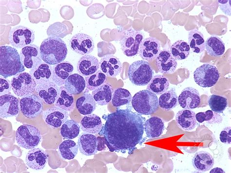 Megakaryocytic maturation - 1.