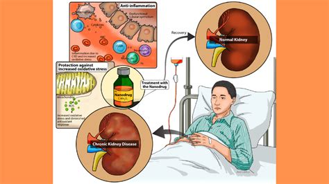 Redox medicine for the treatment of chronic kidney disease ...