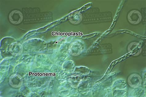 Mnium sp. Protonema. 500X - Mnium sp. - Bryophyta (Mosses) - Botany - Photos