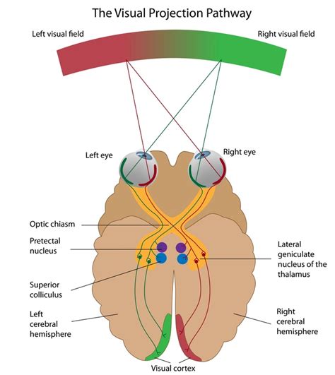 Eye 2 Eye Optometrists: Cortical Visual Impairment