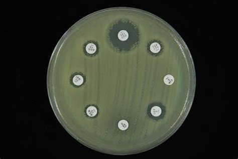 UK government sets out antimicrobial resistance plan | Business | Chemistry World