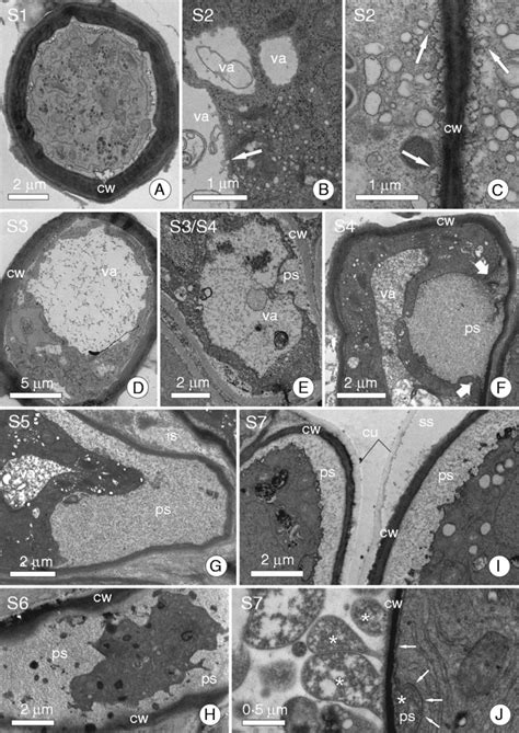 Ultrastructure of some secretory cells showing different secretory... | Download Scientific Diagram