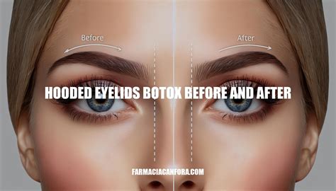 Hooded Eyelids Botox Before and After: A Comprehensive Guide