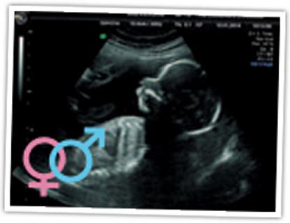 Can I Have a 3D or 4D Ultrasound Scan at 16 Weeks?