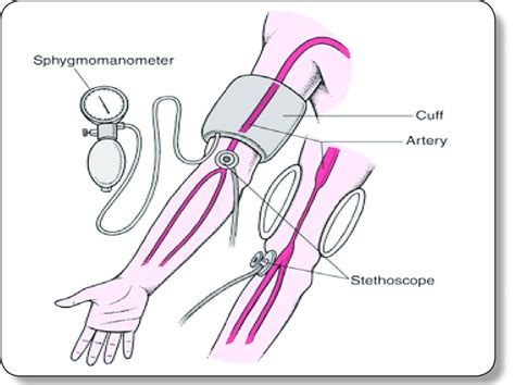 Blood pressure measurement. | Download Scientific Diagram