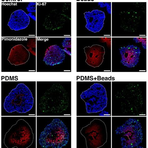 HE staining of spheroids. Spheroids at day 3, 6, and 9 and under each... | Download Scientific ...