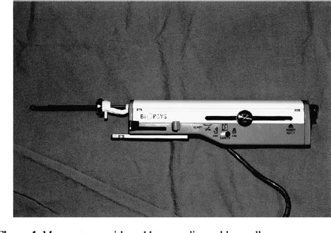 Figure 1 from Breast biopsy for mammographically detected non-palpable ...