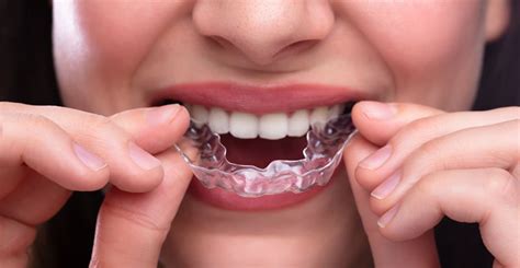 Are Invisalign Reviews Usually Positive in Cedar Park, Texas? - Cedar ...