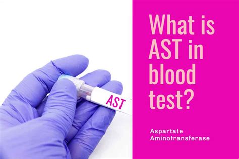 What is AST in blood test? | Aspartate Aminotransferase - Page 2 of 7 ...