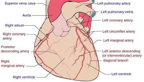 Myocardial infarction – Pathologia