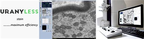 TEM Biological Tissue Staining Alternative to Uranyl Acetate - Rave Scientific