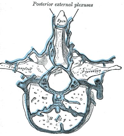 View of Metastasis of lung cancer through Batson’s plexus: very rare ...