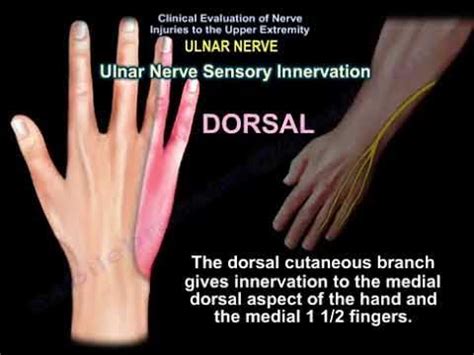 Ulnar Nerve Injury