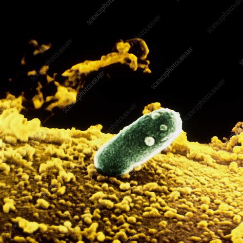 SEM of Rhizobium leguminosarum - Stock Image - B238/0033 - Science Photo Library