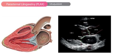 Den ekokardiografiska standardundersökningen - ekg.nu