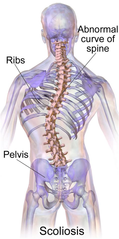 Scoliosis Screening & Treatment in Forked River | Monmouth Pain