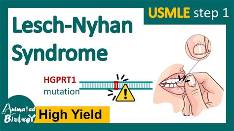 Lesch-Nyhan syndrome | What are the symptoms of Lesch-Nyhan syndrome ...