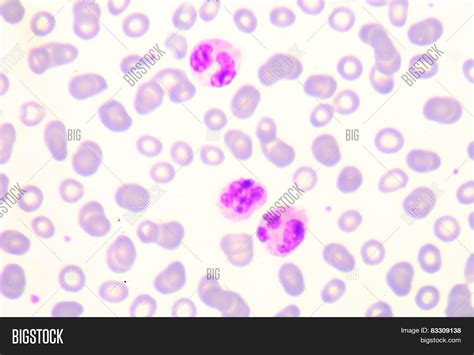 Toxic Granulation Image & Photo (Free Trial) | Bigstock