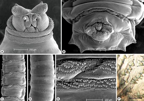 Light microscopic and SEM views of the surface of a maggot. The... | Download Scientific Diagram