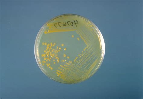 Hafnia alvei antibiotic treatment