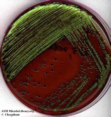 Eosin methylene blue agar (EMB) | Medical Laboratories